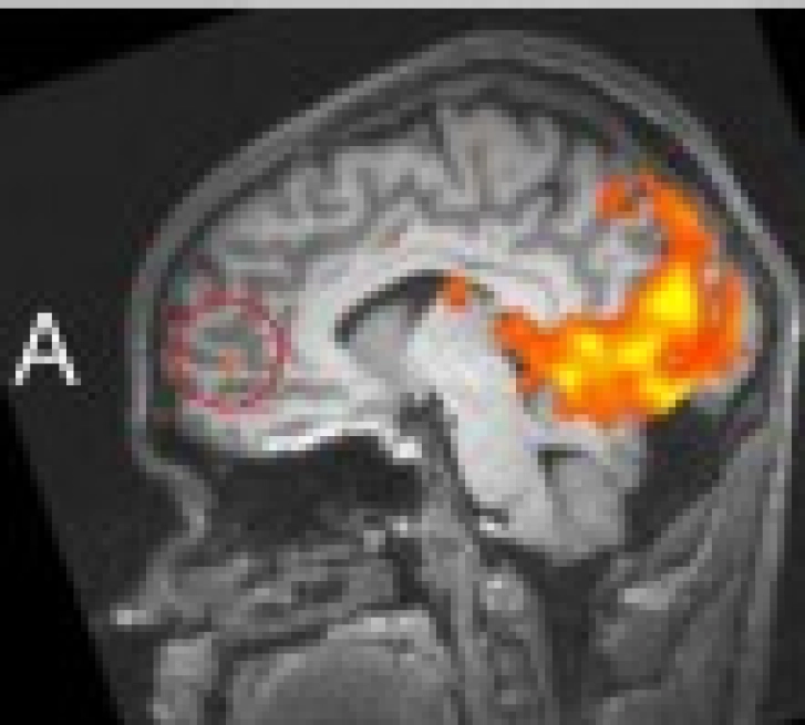 Your Brain on Drug Addicts - Thumbnail