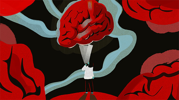 Person standing and looking at image of a red brain above